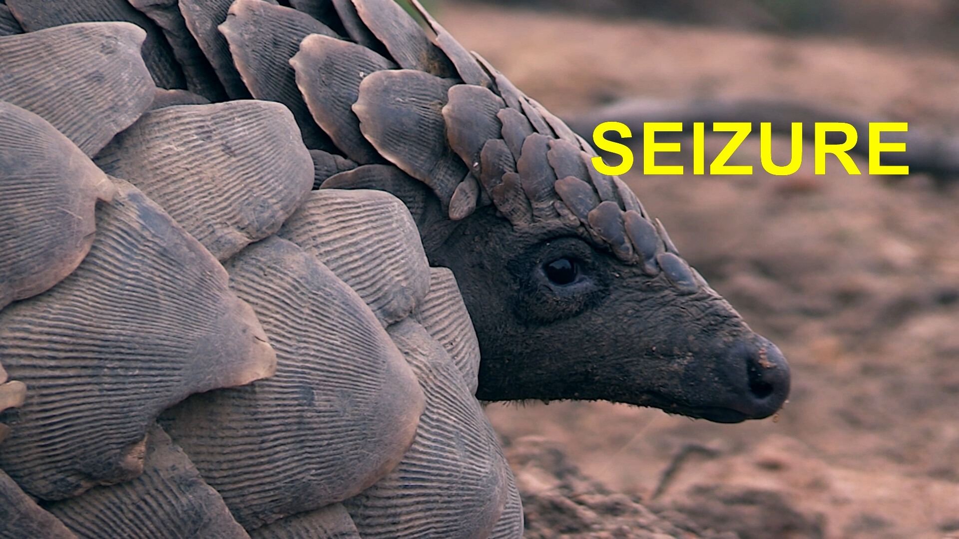 seizure